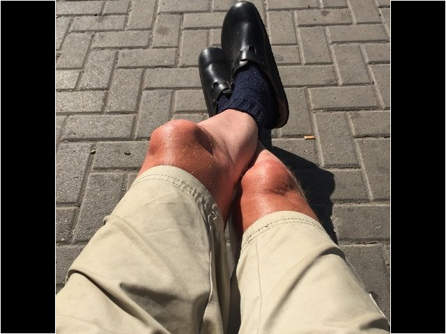 KH-Aufenthalt 2016-09